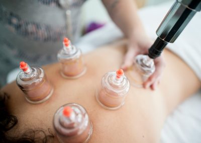 energetique_chinoise-ventouses